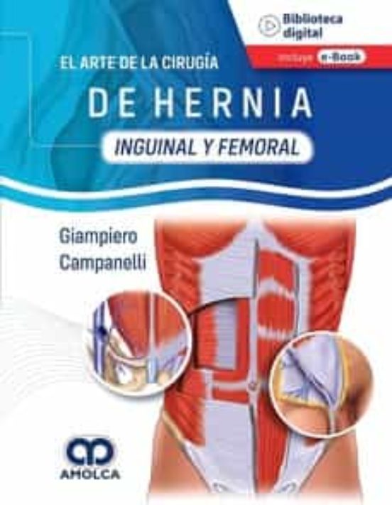 El Arte De La Cirugía De Hernia. Inguinal Y Femoral