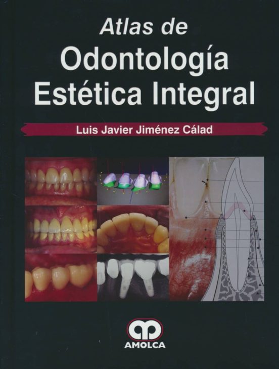 Atlas De Odontologia Estetica Integral