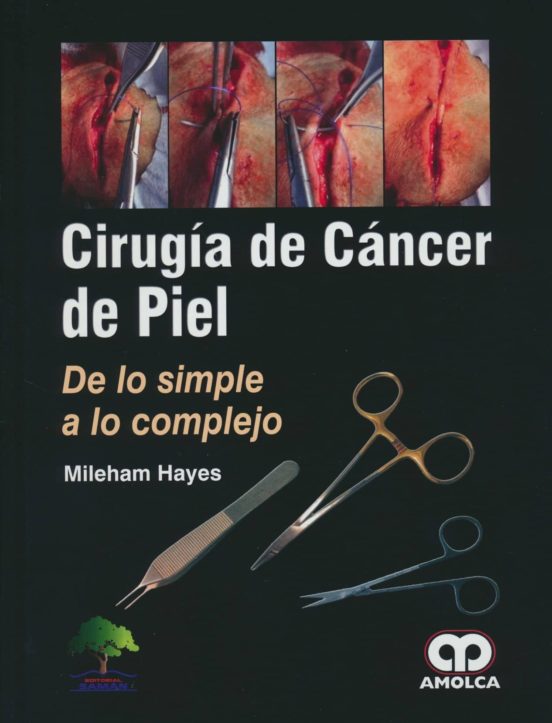 Cirugia De Cancer De Piel