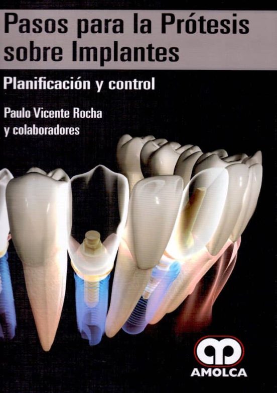 Pasos Para La Protesis Sobre Implantes: Planificacion Y Control