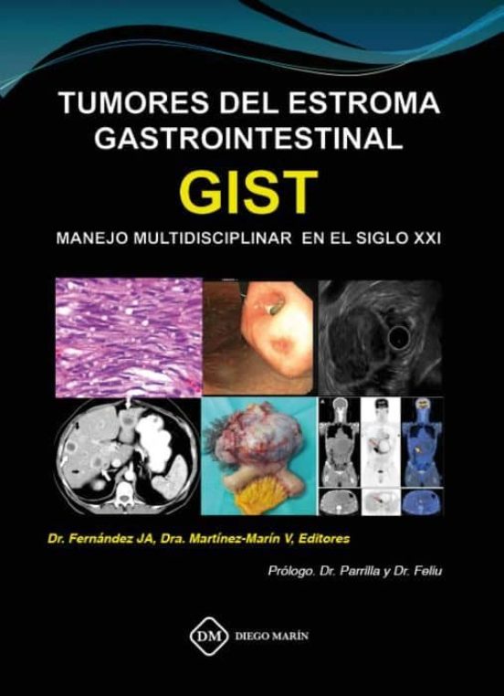 Tumores Del Estroma Gastrointetinal Gist Manejo Multidisciplinar En El