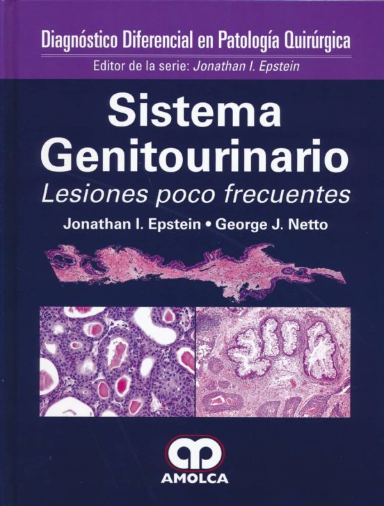 Sistema Genitourinario. Lesiones Poco Frecuentes: Diagnostico Diferenc