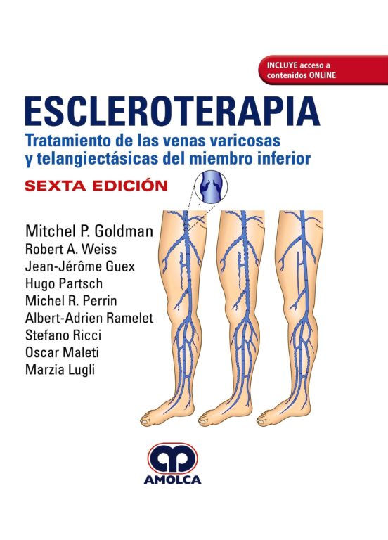 Escleroterapia: Tratamiento De Las Venas Varicosas Y Telangiectás Del