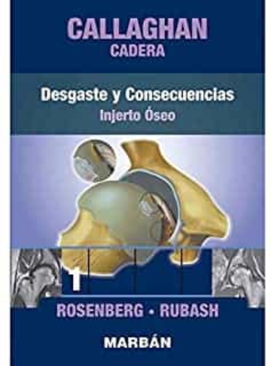 Cadera 1: Desgaste Y Consecuencias. Injerto Óseo