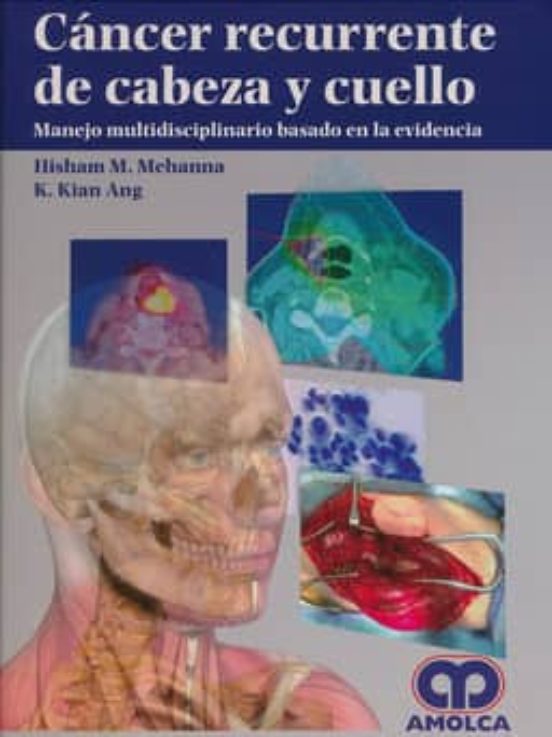 Cancer Recurrente De Cabeza Y Cuello: Manejo Multidisciplinar Basado E