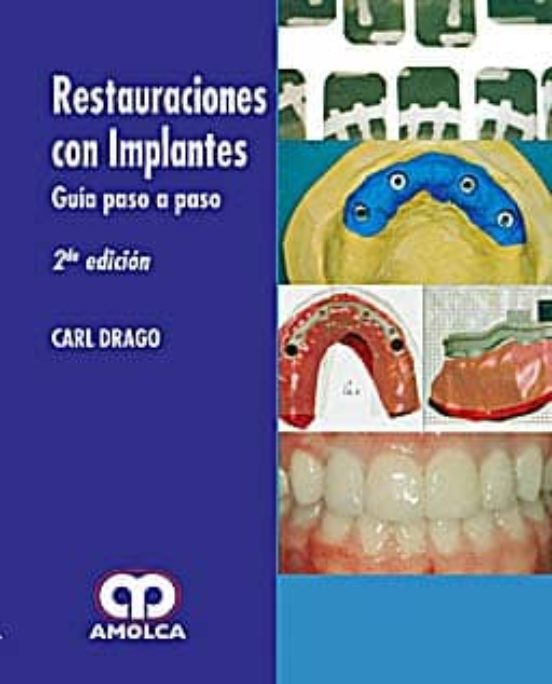 Restauraciones Con Implantes. Guia Paso A Paso