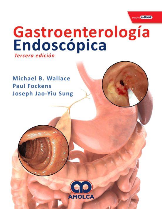 Gastroenterologia Endoscopica + E-boo