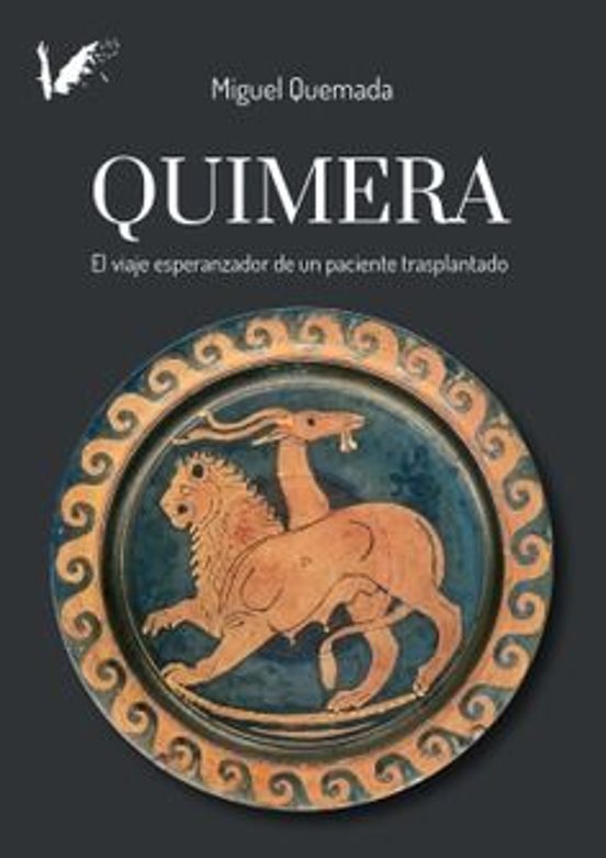 Quimera:viaje Esperanzador De Un Paciente Trasplantado