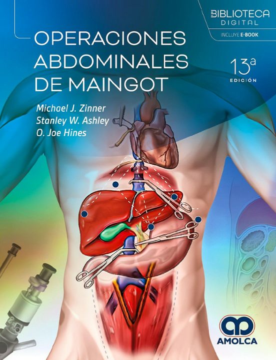 Operaciones Abdominales De Maingot