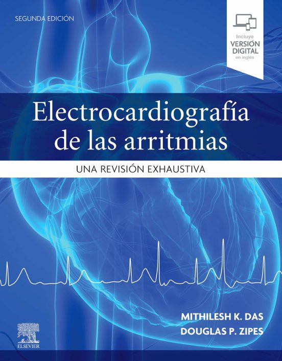 Electrocardiografía De Las Arritmias