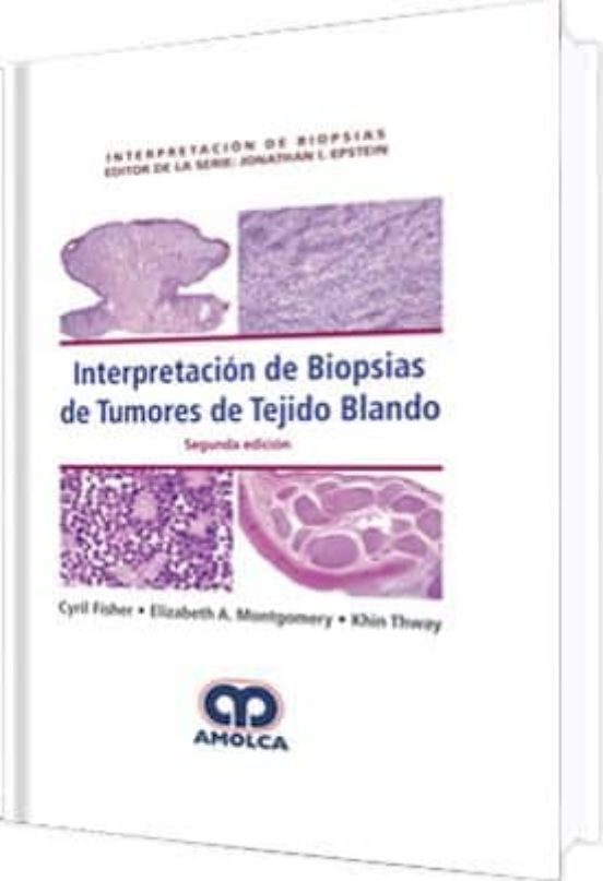 Interpretacion De Biopsias De Tumores Del Tejido Blando