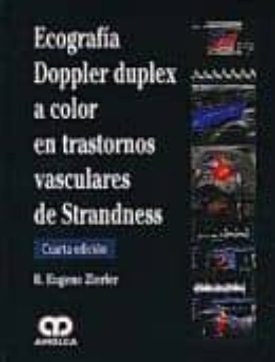 Ecografia Doppler Duplex A Color En Trastornos Vasculares De Stra Ndne