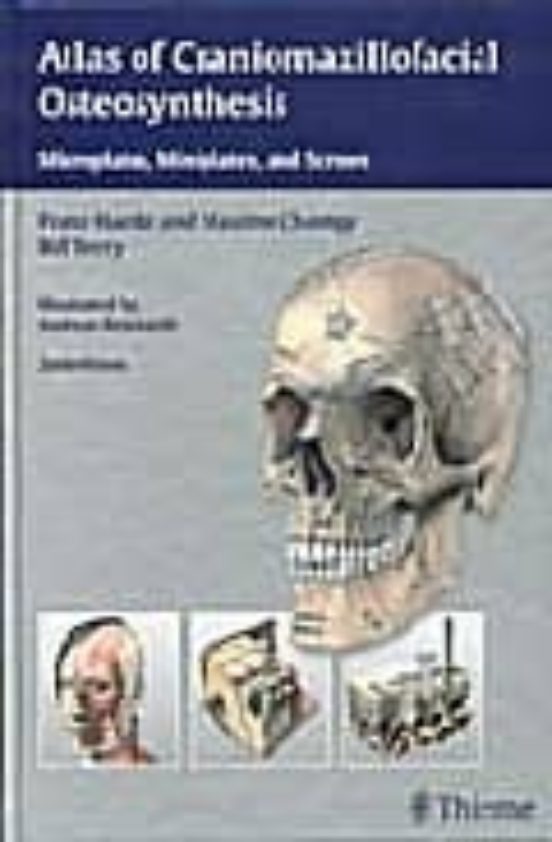 Atlas Of Craniomaxillofacial Osteosynthesis: Microplates Minipla Tes A