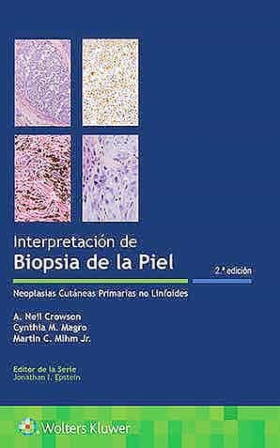 Interpretación De Biopsia De La Piel