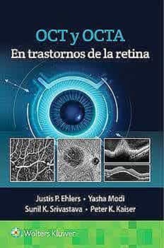 Oct Y Octa En Trastornos De La Retina