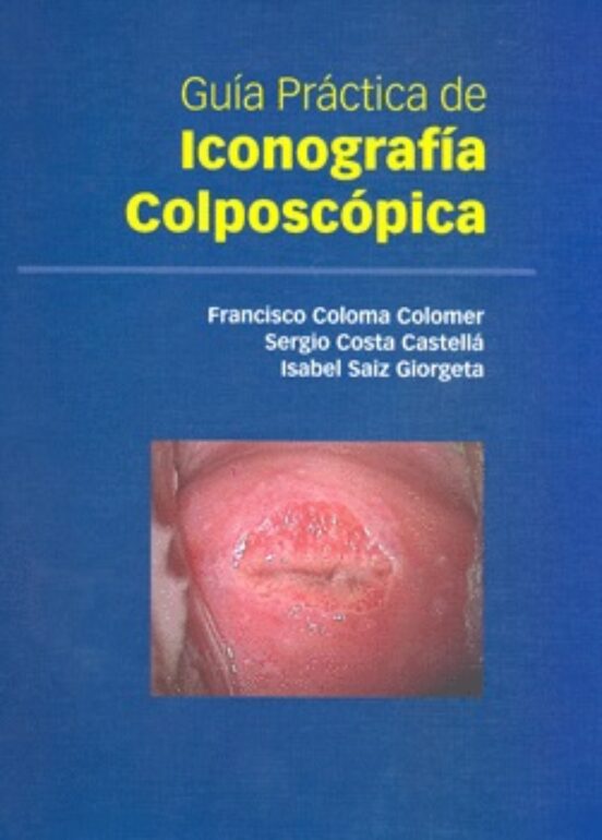 Guia Practica De Iconografia Colposcopica