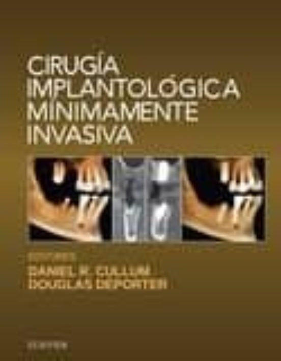 Cirugía Implantológica Mínimamente Invasiva