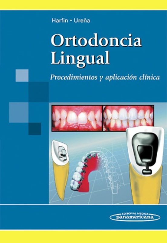 Ortodoncia Lingual