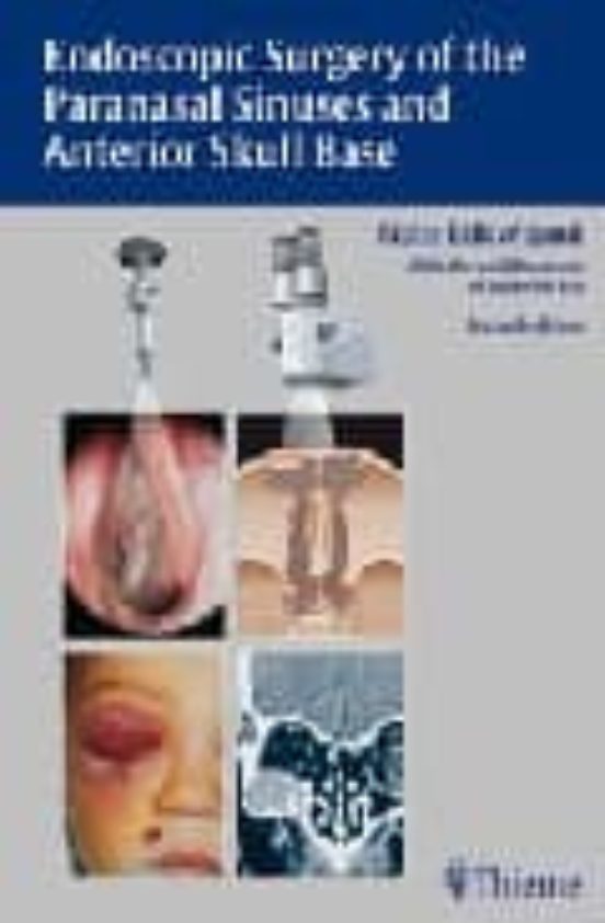 Endoscopic Surgery Of The Paranasal Sinuses And Anterior Skull Ba Se