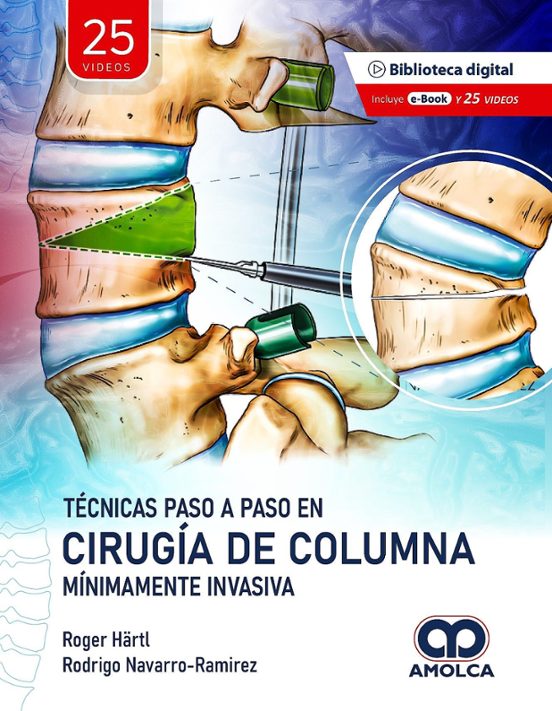 Técnicas Paso A Paso En Cirugía De Columna Mínimamente Invasiva