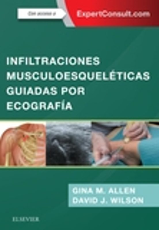 Infiltraciones Musculoesqueléticas Guiadas Por Ecografía