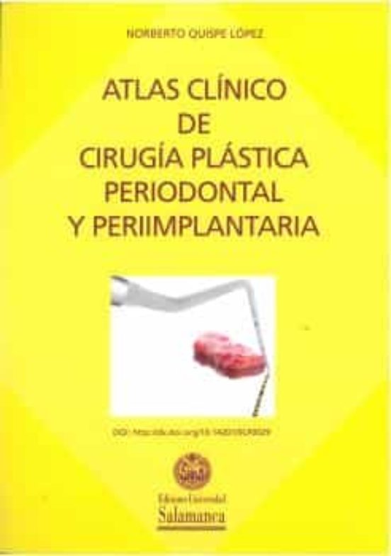 Atlas Clinico De Cirugia Plastica Periodontal Y Periimplantaria
