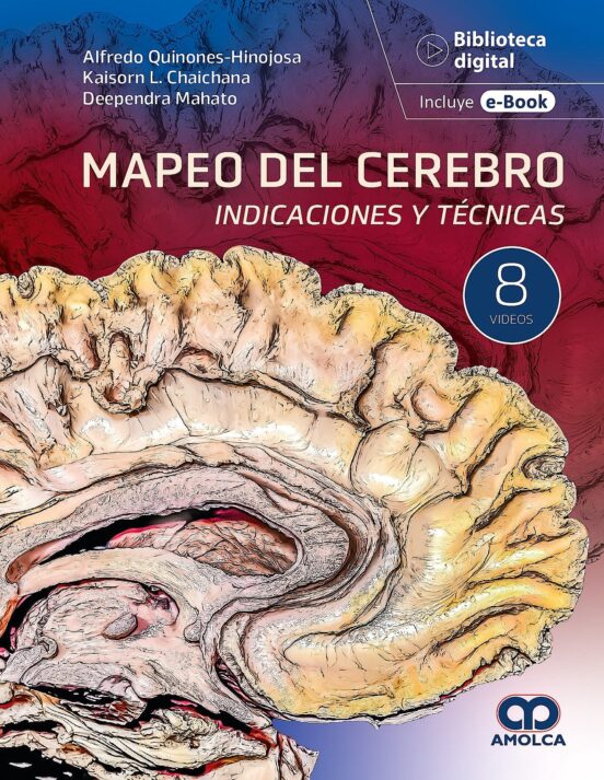 Mapeo Del Cerebro. Indicaciones Y Técnicas