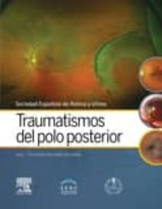 Traumatismos Del Polo Posterior