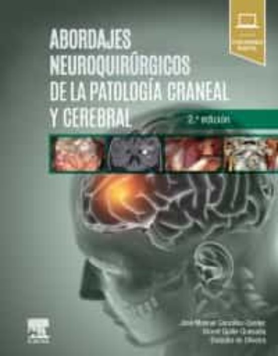 Abordajes Neuroquirúrgicos De La Patología Craneal Y Cerebral