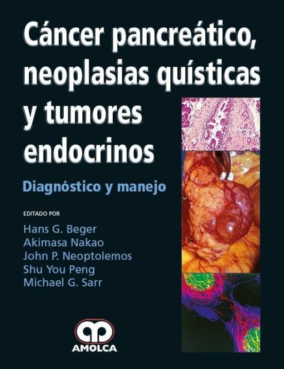 Cancer Pancreatico Neoplasias Quisticas Y Tumores Endocrinos