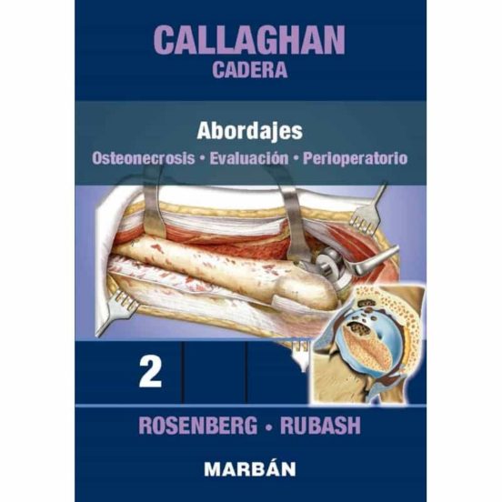 Cadera 2: Abordajes. Osteonecrosis. Evaluación. Perioperatorio