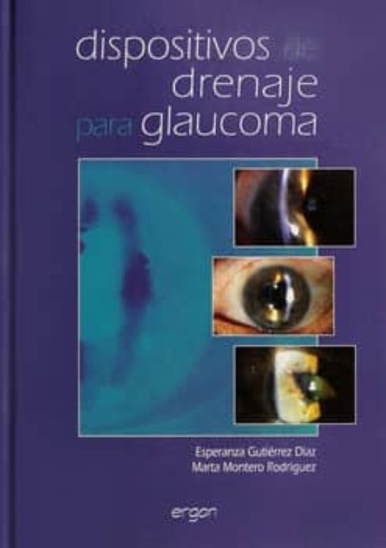 Dispositivos De Drenaje Para Glaucoma