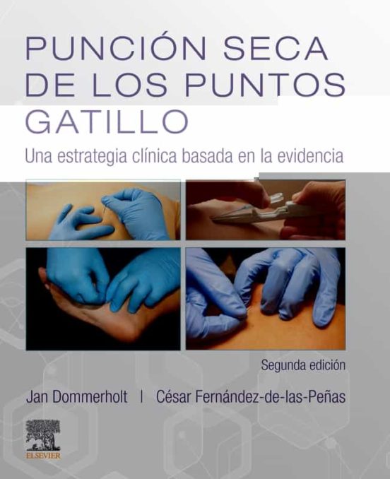 Punción Seca De Los Puntos Gatillo