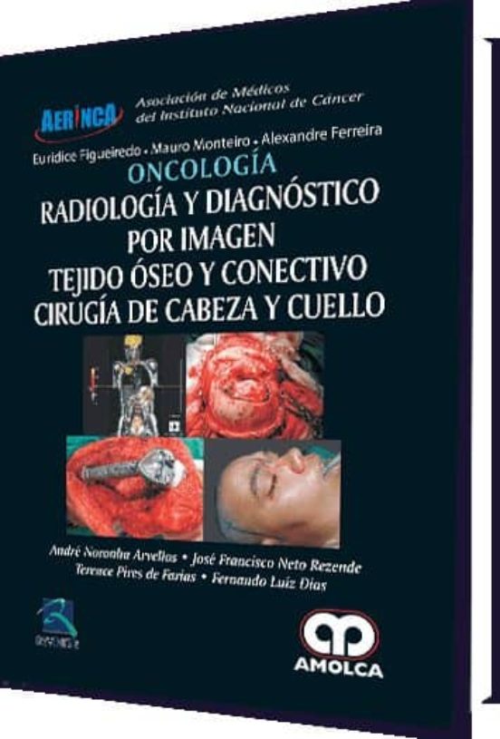Oncologia: Radiologia Y Diagnostico Por Imagen: Tejido Oseo Y Conectiv