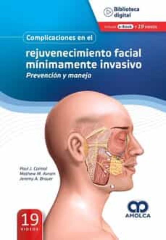 Complicaciones En El Rejuvenecimiento Facial Mínimamente Invasivo. Pre