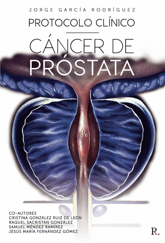 Protocolo Clinico Cancer De Prostata