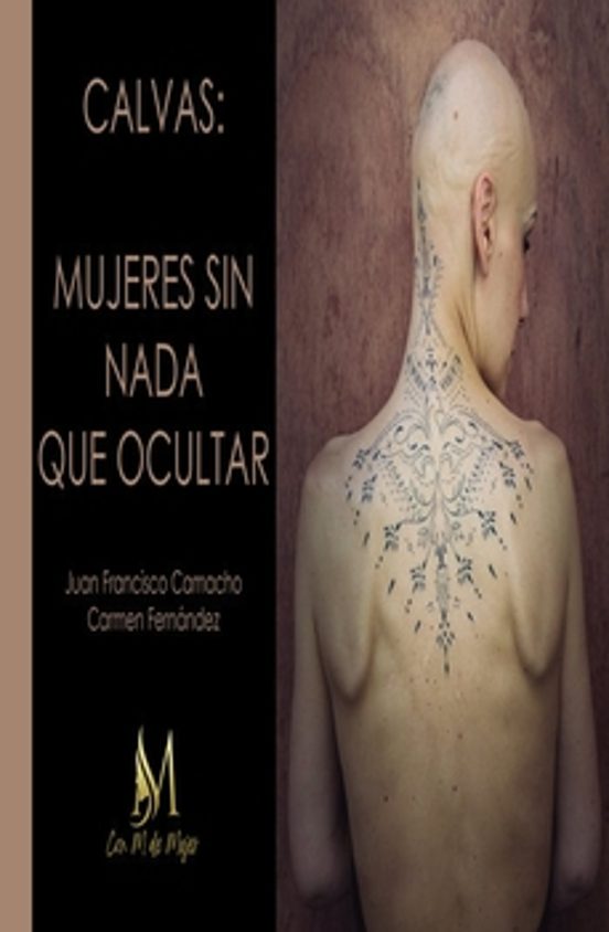 Calvas: Mujeres Sin Nada Que Ocultar