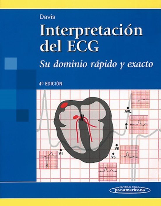 Interpretacion Del Ecg : Su Dominio Rapido Y Exacto