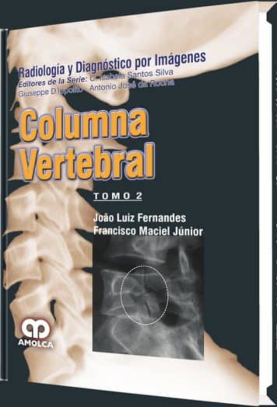 Columna Vertebral : Radiologia Y Diagnostico Por Imagenes