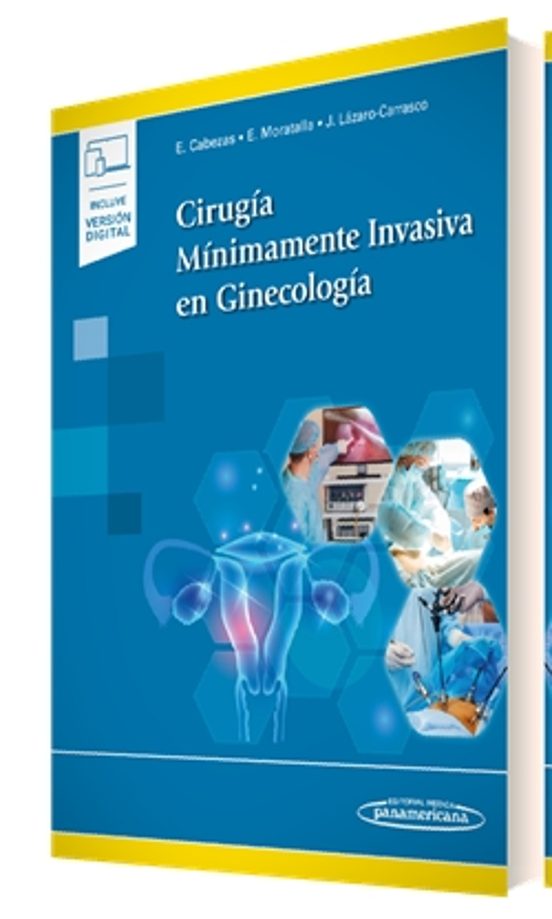Cirugía Mínimamente Invasiva En Ginecología
