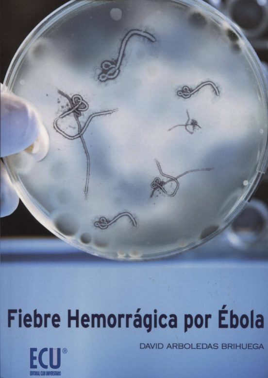 Fiebre hemorrágica por Ébola