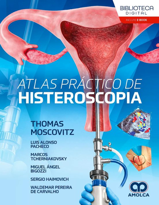 Atlas práctico de histeroscopia