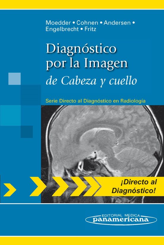 Diagnostico Por La Imagen De Cabeza Y Cuello