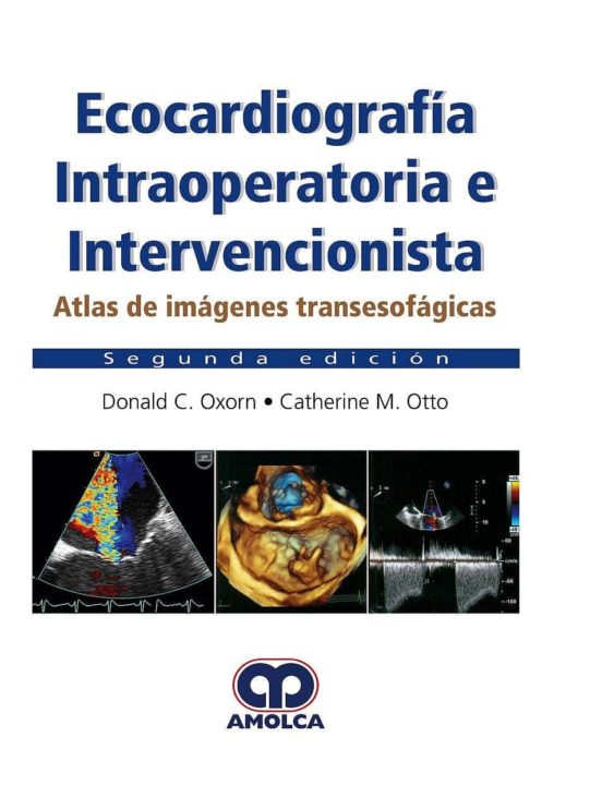 Ecocardiografia Intraoperatoria E Intervencionista: Atlas De Imagenes
