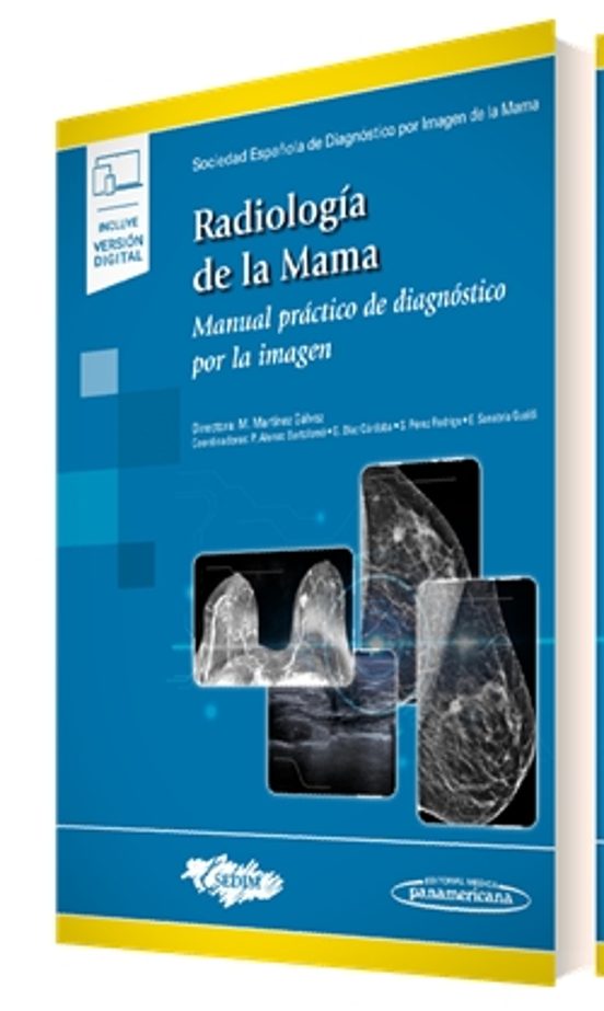 Radiologia De La Mama