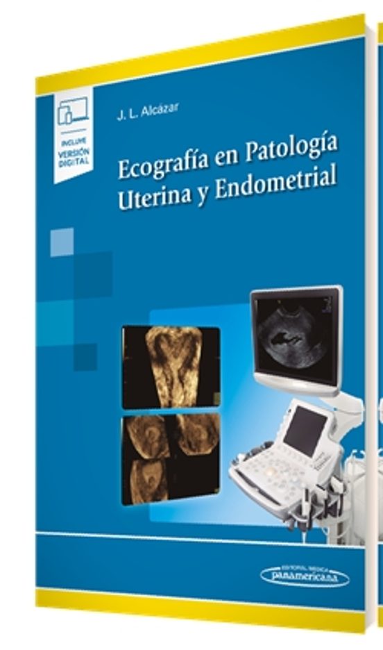 Ecografia En Patologia Uterina Y Endometrial