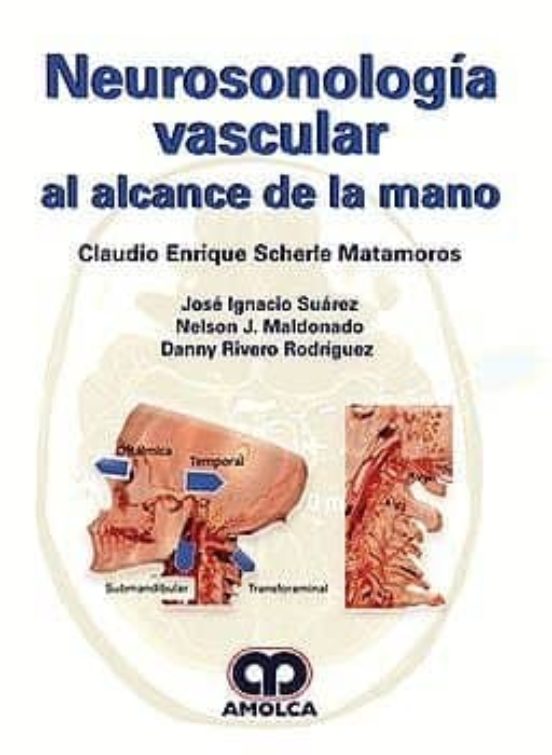 Neurosonologia Vascular