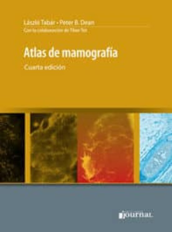 Atlas De Mamografia