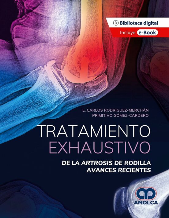 Tratamiento Exhaustivo De La Artrosis De Rodilla. Avances Recientes