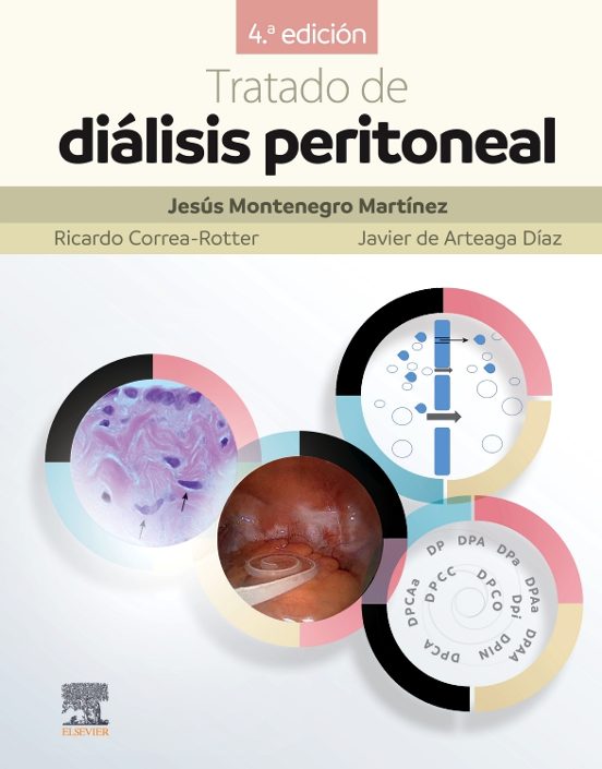 Tratado De Diálisis Peritoneal